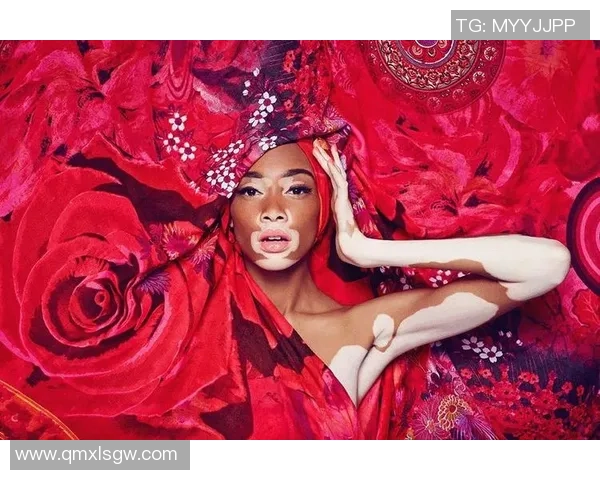 足球明星女友勇敢面对白癜风挑战展现坚强与美丽 足球明星女友勇敢面对白癜风挑战展现坚强与美丽